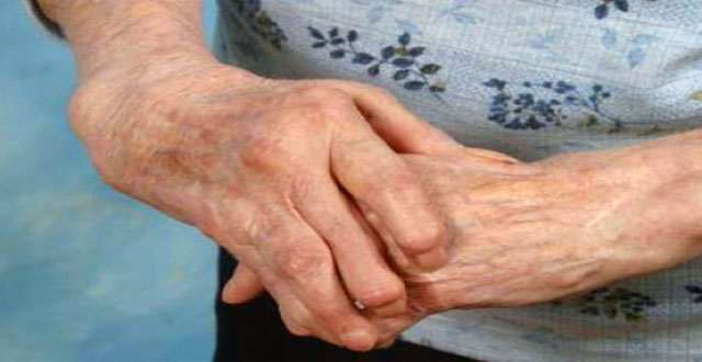 Que es artritis reumatoide