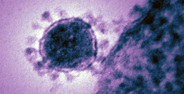Coronavirus epidemia