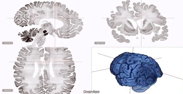 Mapa cerebral 3D
