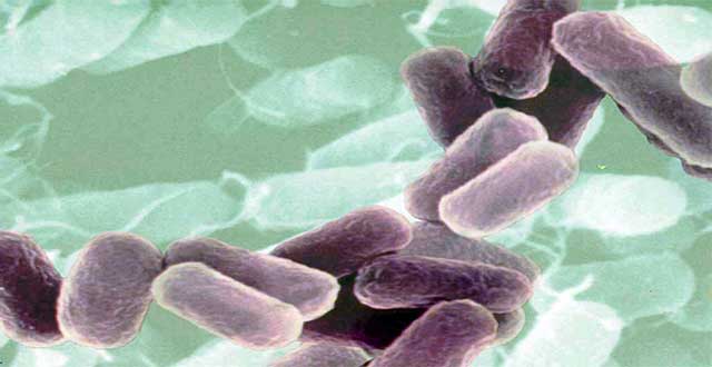 Identificar bacterias perjudiciales